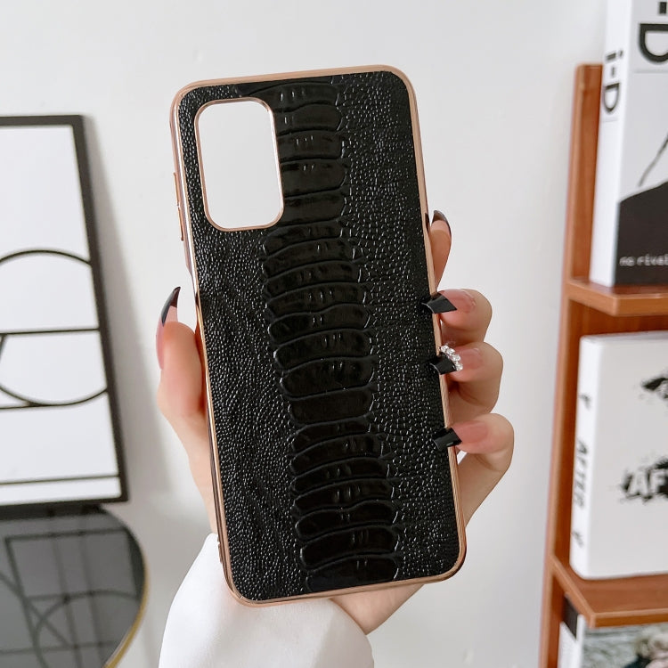 Note 11E Pro Genuine Leather Weilai Series Nano Plating Phone Case(Black) Eurekaonline