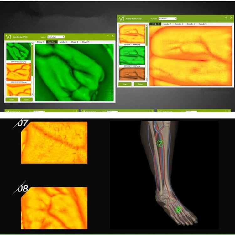 P2-1 Vascular Vein Display Inspection Camera Eurekaonline